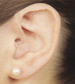 ear wax removal edgware